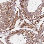 Immunohistochemical staining of human testis shows strong granular cytoplasmic positivity in Leydig cells.