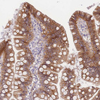 Anti-C2orf88 Antibody