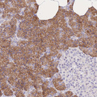 Immunohistochemical staining of human pancreas shows strong membranous/cytoplasmic positivity in exocrine glandular cells.