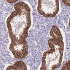 Immunohistochemical staining of human endometrium shows strong membranous/cytoplasmic positivity in glandular cells.
