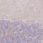 Immunohistochemical staining of human cerebellum shows no positivity in Purkinje cells, as expected.