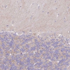 Immunohistochemical staining of human cerebellum shows no positivity in Purkinje cells, as expected.