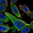 Anti-TCTEX1D2 Antibody