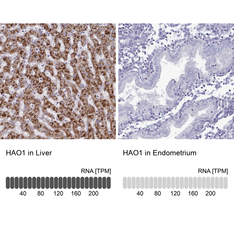 Anti-HAO1 Antibody