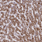 Immunohistochemical staining of human liver shows strong granular cytoplasm positivity in hepatocytes.
