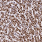Immunohistochemical staining of human liver shows strong granular cytoplasm positivity in hepatocytes.