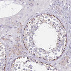 Immunohistochemical staining of human testis shows moderate granular cytoplasm positivity in cells in seminiferous ducts.