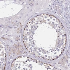 Immunohistochemical staining of human testis shows moderate granular cytoplasm positivity in cells in seminiferous ducts.