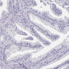 Immunohistochemical staining of human prostate shows no positivity in glandular cells.