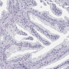 Immunohistochemical staining of human prostate shows no positivity in glandular cells.