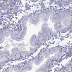 Immunohistochemical staining of human endometrium shows no positivity in glandular cells as expected.