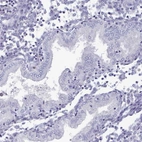 Immunohistochemical staining of human endometrium shows no positivity in glandular cells as expected.