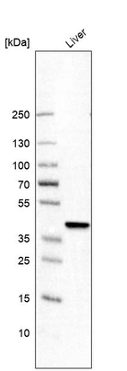 Western blot analysis in human liver tissue.
