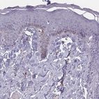 Immunohistochemical staining of human skin shows very weak cytoplasmic positivity in squamous epithelial cells.