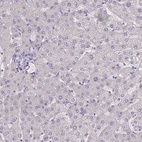 Anti-SLC35E4 Antibody