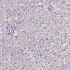 Immunohistochemical staining of human liver shows no positivity in hepatocytes as expected.
