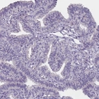Immunohistochemical staining of human Fallopian tube shows no positivity in glandular cells as expected.