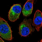 Immunofluorescent staining of human cell line PC-3 shows localization to cytosol.