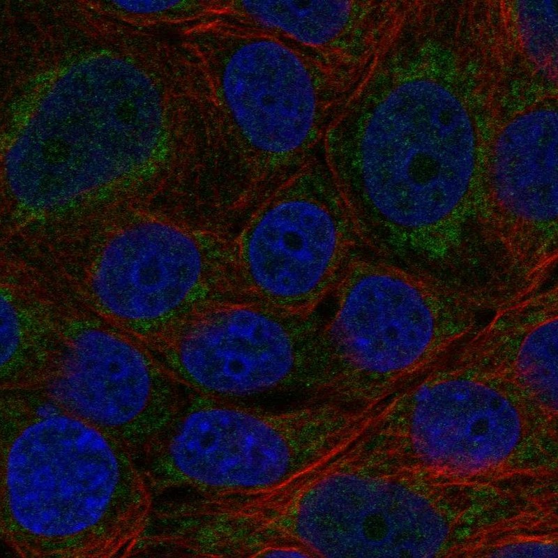 Anti-CYP11B2 Antibody
