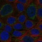 Anti-CYP11B2 Antibody