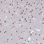 Anti-PLEKHG5 Antibody