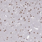 Anti-PLEKHG5 Antibody