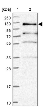 Lane 1: Marker [kDa] 250, 130, 95, 72, 55, 36, 28, 17, 10_br/_Lane 2: Human cell line RT-4