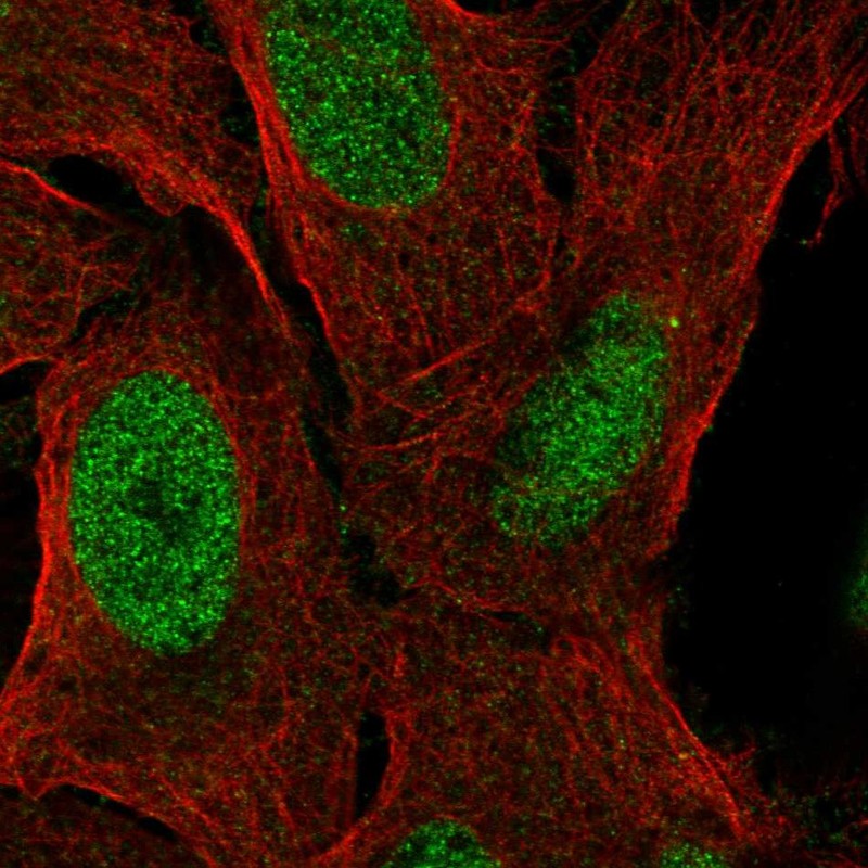 Anti-ZNF296 Antibody