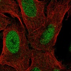 Anti-ZNF296 Antibody