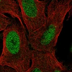 Anti-ZNF296 Antibody