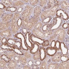 Anti-PALM Antibody