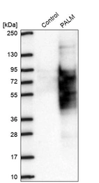 Western blot analysis in control (vector only transfected HEK293T lysate) and PALM over-expression lysate (Co-expressed with a C-terminal myc-DDK tag (~3.1 kDa) in mammalian HEK293T cells, LY419238).