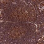 Immunohistochemical staining of human lymphoid tissues shows strong granular cytoplasmic positivity in in germinal and non germinal center cells.