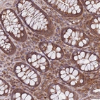 Immunohistochemical staining of human colon shows strong granular cytoplasmic positivity in glandular cells.