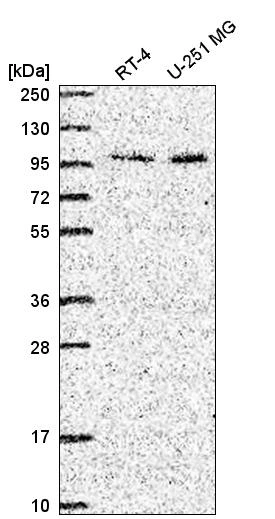 Rabbit Polyclonal Anti-ZXDC Antibody - Buy for research - Highly ...