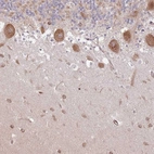 Immunohistochemical staining of human cerebellum shows strong granular cytoplasmic positivity in Purkinje cells.
