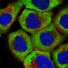 Immunofluorescent staining of human cell line A-431 shows localization to cytosol.