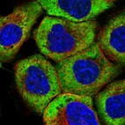 Immunofluorescent staining of human cell line A-431 shows localization to cytosol.