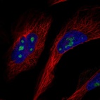 Anti-GLTSCR2 Antibody