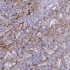 Anti-KRIT1 Antibody