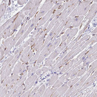 Anti-KRIT1 Antibody