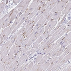 Immunohistochemical staining of human heart muscle shows strong cytoplasmic positivity in blood vessels.