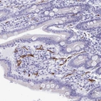 Immunohistochemical staining of human duodenum shows strong cytoplasmic positivity in blood vessels.
