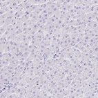 Anti-KRIT1 Antibody