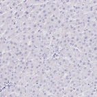 Immunohistochemical staining of human liver shows no cytoplasmic positivity in hepatocytes.