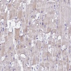 Anti-MRM2 Antibody