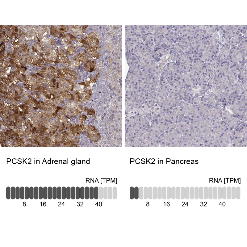 Anti-PCSK2 Antibody
