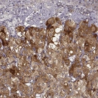 Immunohistochemical staining of human adrenal gland shows strong cytoplasmic positivity in adrenal medulla.