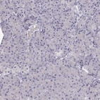 Immunohistochemical staining of human pancreas shows low expression as expected.
