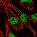 Immunofluorescent staining of human cell line SK-MEL-30 shows localization to nucleoplasm & vesicles.